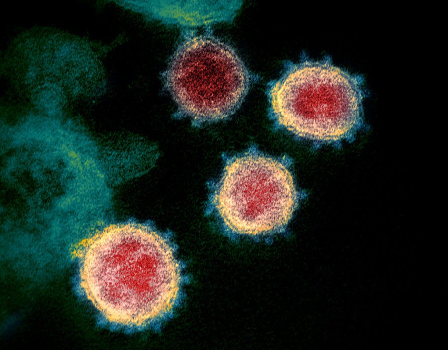 This undated electron microscope image made available by the U.S. National Institutes of Health in February 2020 shows the virus that causes COVID-19. The sample was isolated from a patient in the U.S. Excitement about treating the new coronavirus with malaria drugs is raising hopes, but the evidence that they may help is thin.