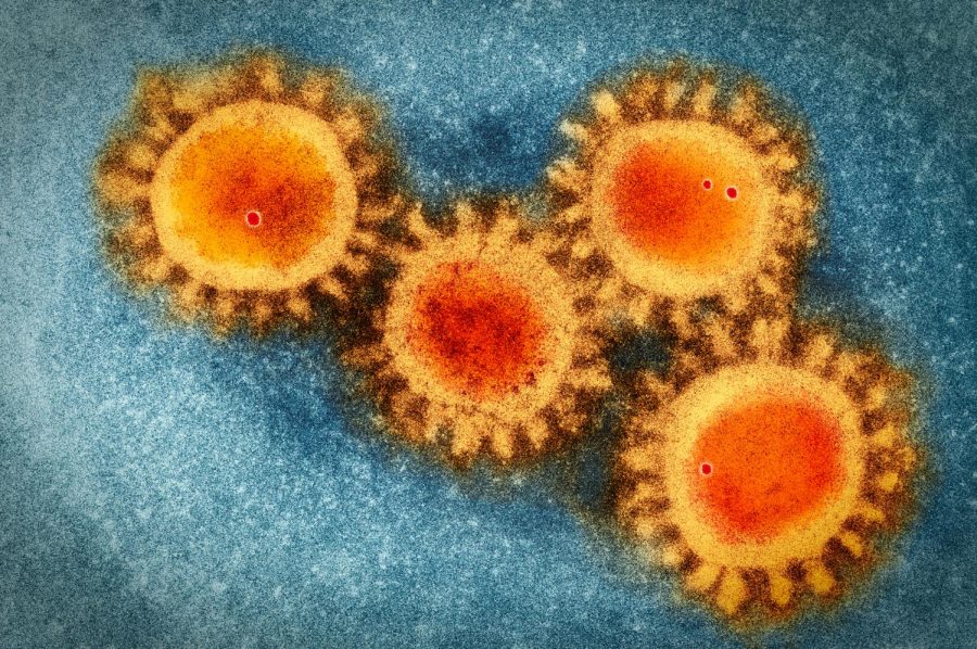Colored visualization of electron microscopy photo of the coronavirus COVID-19