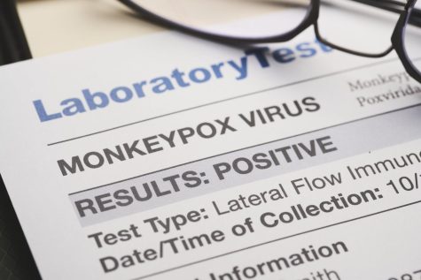 NIU reports first case of monkeypox virus