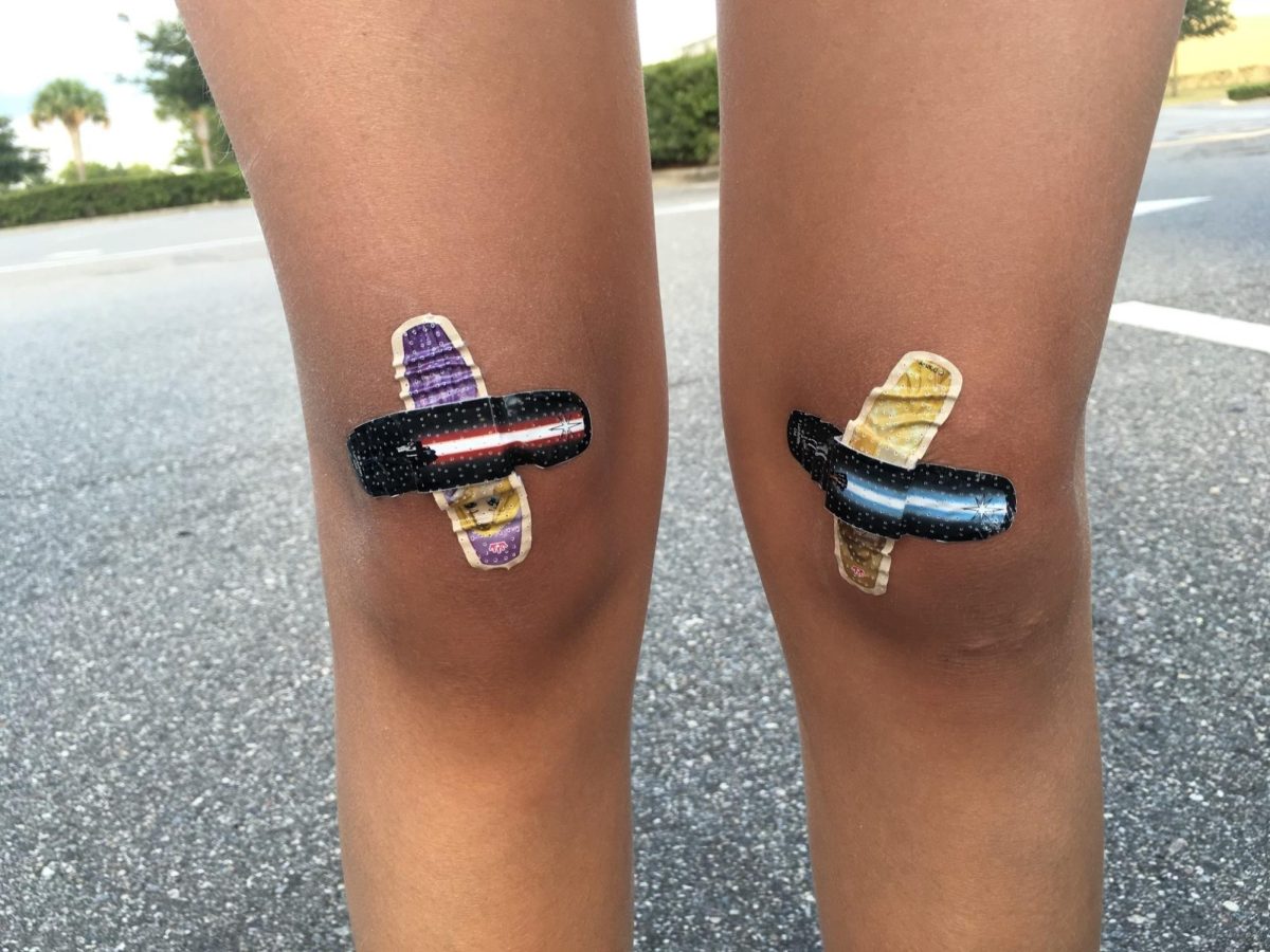 Opinion Editor Lucy Atkinson’s 12-year-old knees are crossed with bandaids. For children, scrapes are evidence of fun at the playground, just like failures as adults should be viewed as evidence of progress. (Courtesy of Shelley Atkinson)